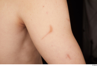 Gruffydd arm nude scar 0001.jpg